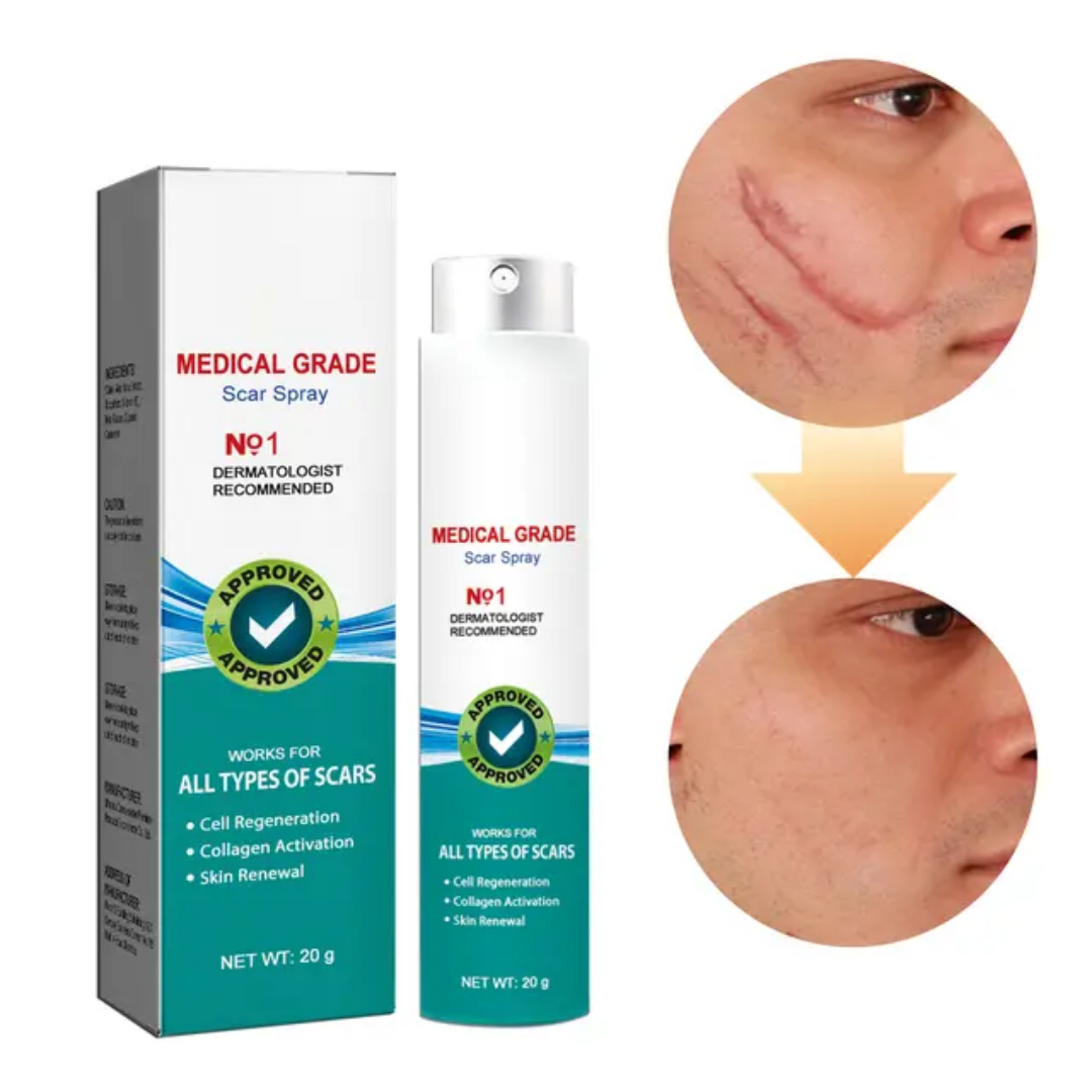✨✨ SPRAY ANTI-CICATRICES – DITES ADIEU AUX CICATRICES ET RETROUVEZ UNE PEAU PARFAITE ! ✨